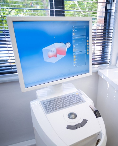 CEREC digital impressions on chairside computer