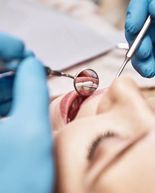 Male dental patient during dental checkup and cleaning in Billerica, MA