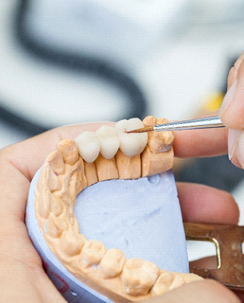 close up of dentist working on dental bridge in Billerica