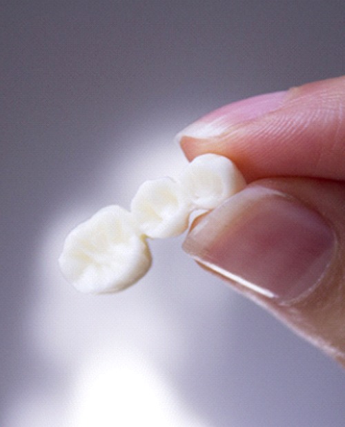 close up of person holding dental bridge in Billerica