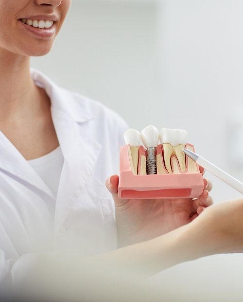 Dentist holding up a model comparing traditional teeth to dental implant supported replacement teeth