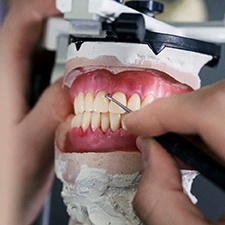dentures in an articulator being trimmed by a lab technician