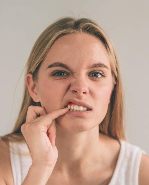 Woman in need of scaling and root planing periodontal therapy looking at her smile