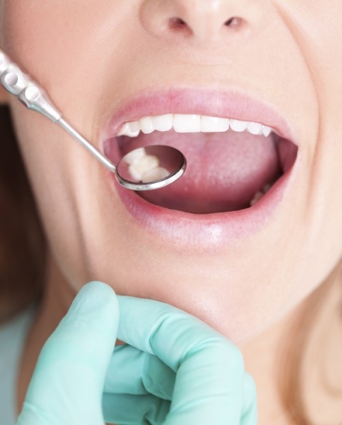 Dentist examining patient's smile after tooth-colored filling restorative dentistry