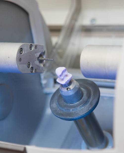 Milling unit crafting a CEREC same day dental crown