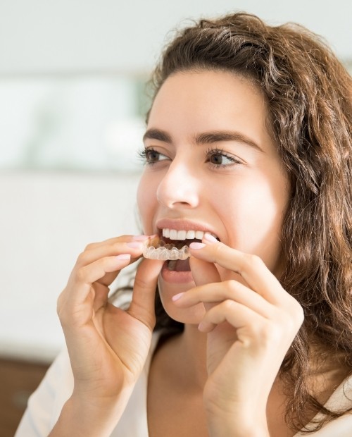 Woman placing an Invisalign clear braces tray