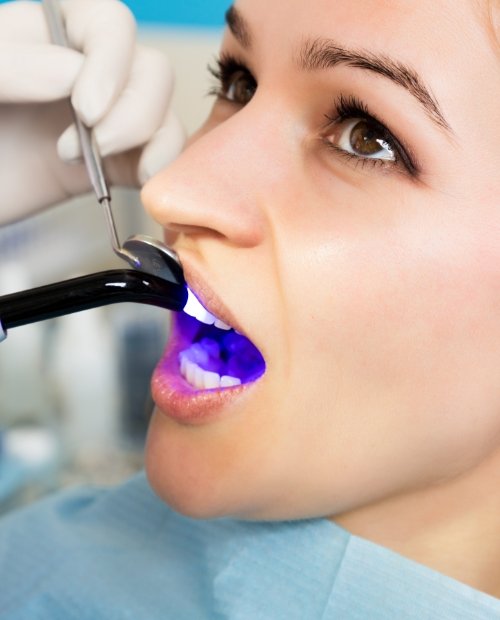 Patient receiving cosmetic dental bonding treatment