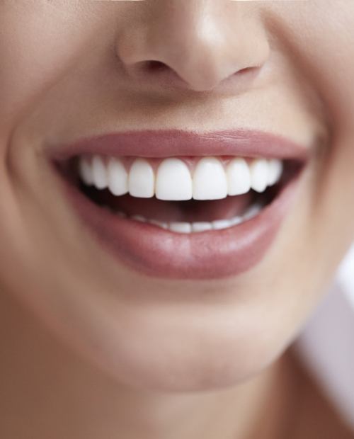 Closeup of bright smile after at-home teeth whitening treatment