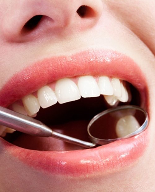TExamining a patient’s mouth with a dental mirror