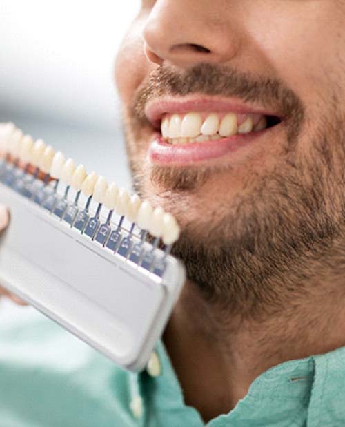 Cosmetic dentist in Billerica holding up shades of porcelain