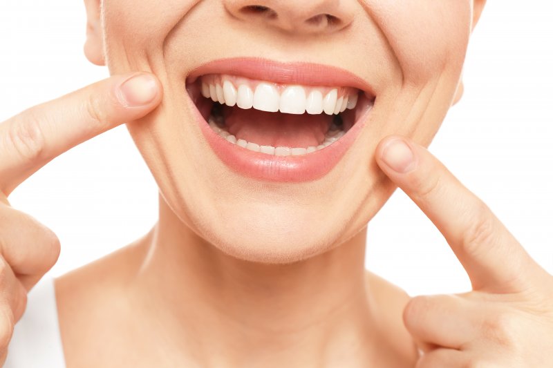 patient smiling and pointing to veneers in Billerica
