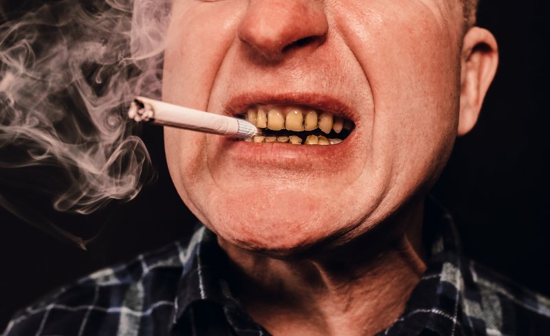 Man smoking with dentures