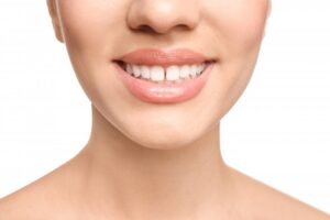 Woman smiling with a gap between her two front teeth